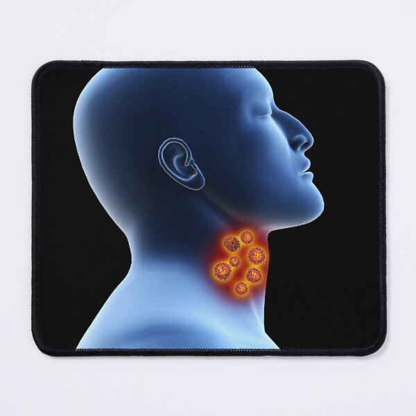 Item preview, STK701497H-Coronavirus in the human throat. designed and sold by StocktrekImages.