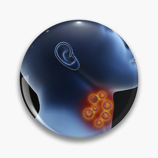 Item preview, STK701497H-Coronavirus in the human throat. designed and sold by StocktrekImages.
