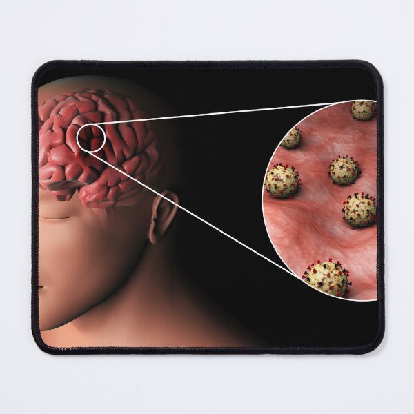 Item preview, STK701527H-Eastern equine encephalitis inside the brain, with magnified section. designed and sold by StocktrekImages.