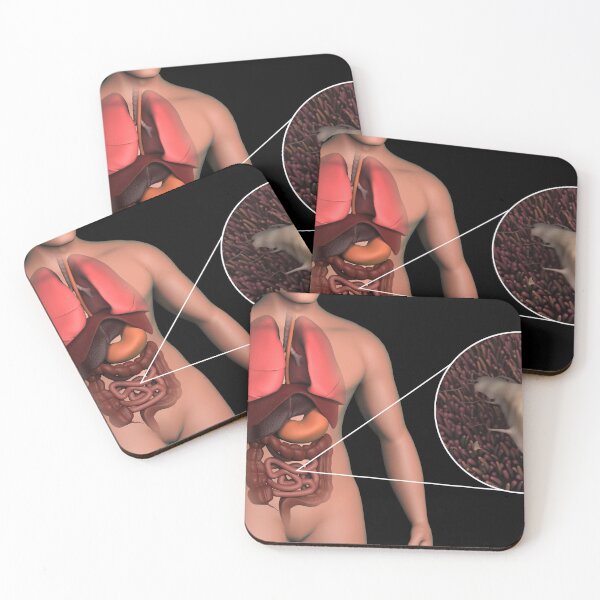 Item preview, STK701528H-Giardia parasite inside the small intestine, with magnified section. designed and sold by StocktrekImages.