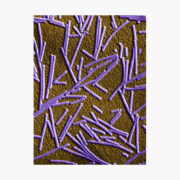 Tobacco Mosaic Virus, TEM
