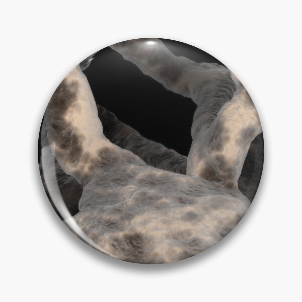 Item preview, STK701547H-Bone structure of osteoporosis. designed and sold by StocktrekImages.