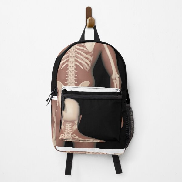 Item preview, STK701550H-Normal human spine vs. a spine with scoliosis. designed and sold by StocktrekImages.