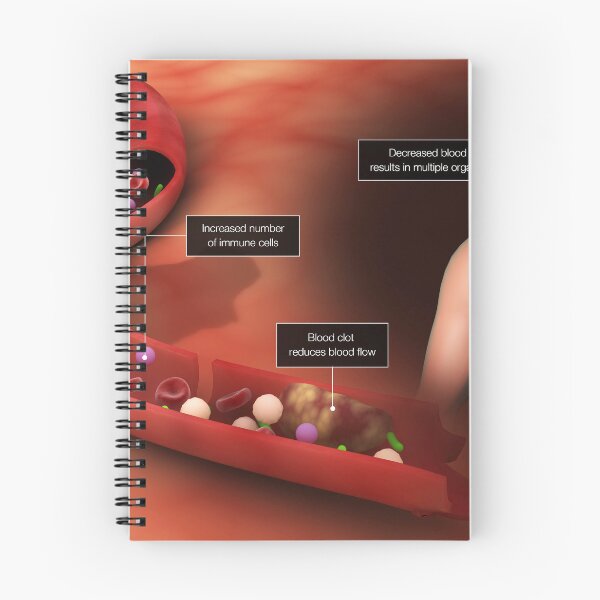 Item preview, STK701551H-Sepsis in the bloodstream designed and sold by StocktrekImages.
