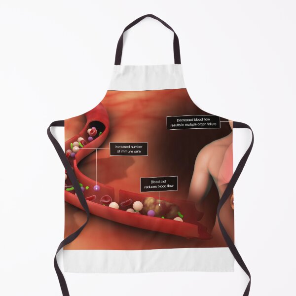 Item preview, STK701551H-Sepsis in the bloodstream designed and sold by StocktrekImages.