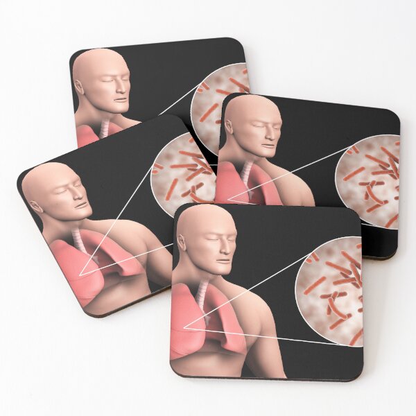 Item preview, STK701552H-Tuberculosis in the human lungs. designed and sold by StocktrekImages.