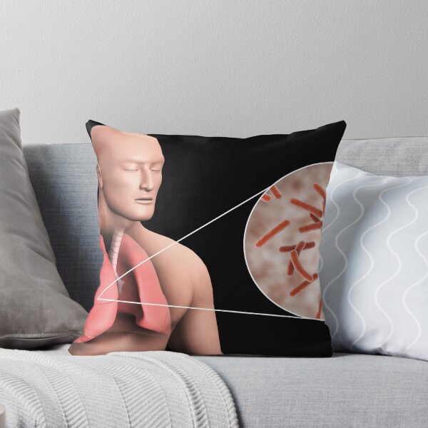 Item preview, STK701552H-Tuberculosis in the human lungs. designed and sold by StocktrekImages.
