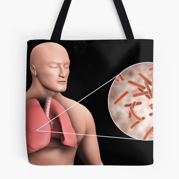 Item preview, STK701552H-Tuberculosis in the human lungs. designed and sold by StocktrekImages.