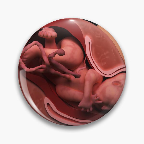 Item preview, STK701560H-Cervical effacement and dilation of the cervix during childbirth. designed and sold by StocktrekImages.