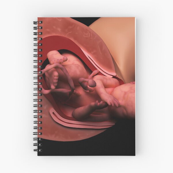 Item preview, STK701561H-Delivery of fetus in womb. designed and sold by StocktrekImages.