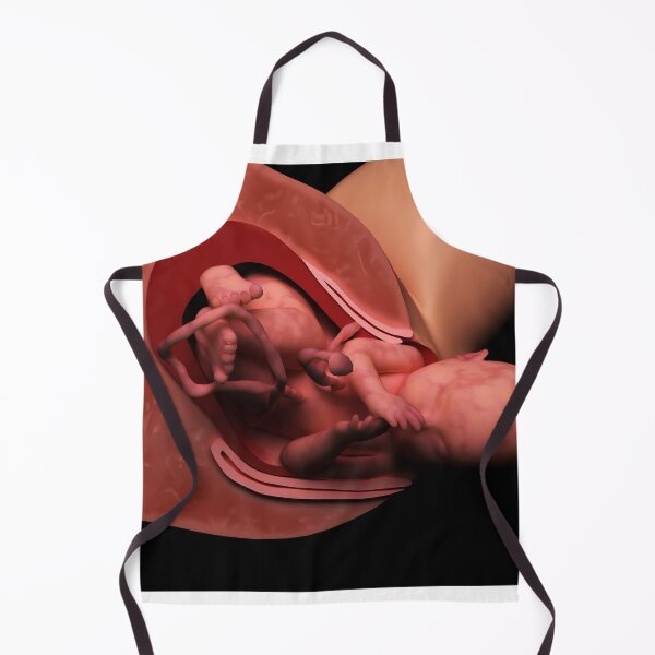 Item preview, STK701561H-Delivery of fetus in womb. designed and sold by StocktrekImages.