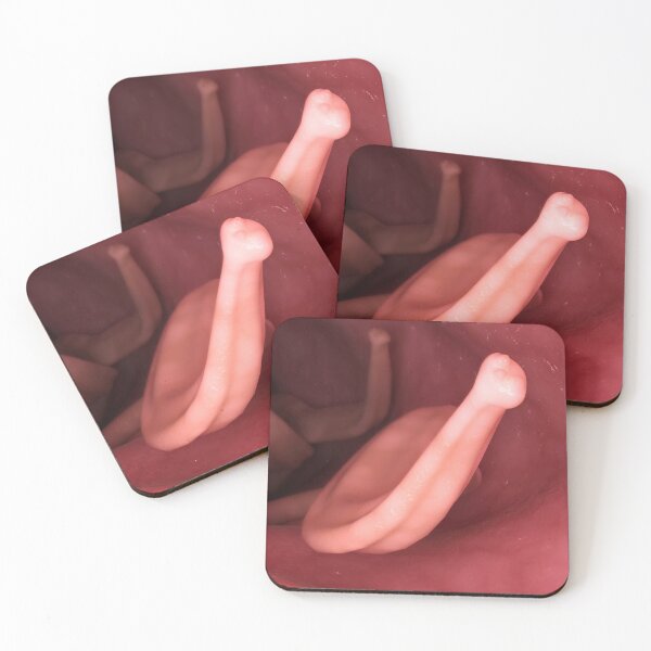 Item preview, STK701569H-Ascaris lumbricoides in the human intestines. designed and sold by StocktrekImages.