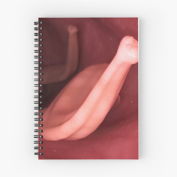 Item preview, STK701569H-Ascaris lumbricoides in the human intestines. designed and sold by StocktrekImages.