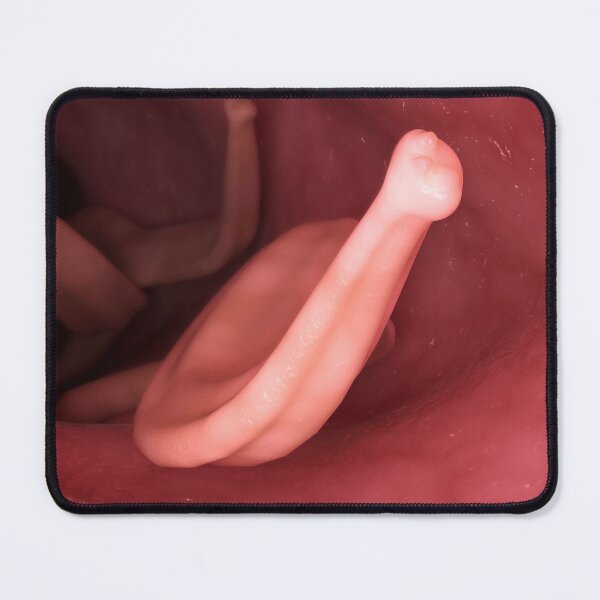 Item preview, STK701569H-Ascaris lumbricoides in the human intestines. designed and sold by StocktrekImages.