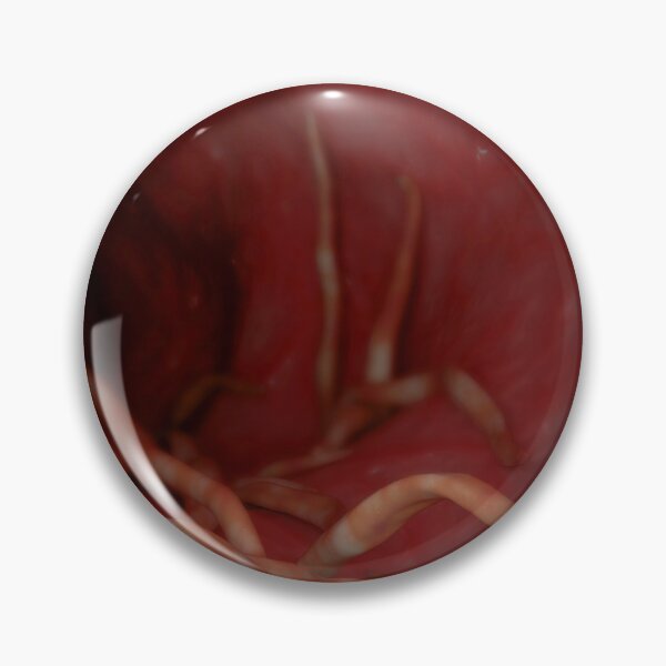 Item preview, STK701570H-Ascaris lumbricoides in the human intestines. designed and sold by StocktrekImages.