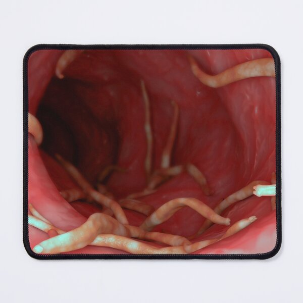 Item preview, STK701570H-Ascaris lumbricoides in the human intestines. designed and sold by StocktrekImages.