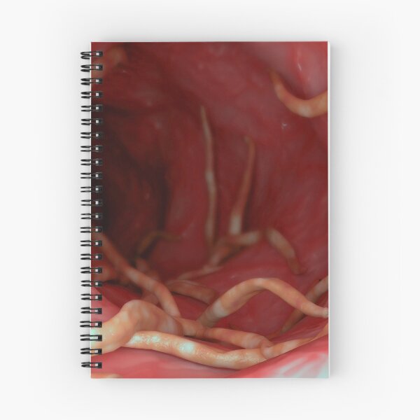 Item preview, STK701570H-Ascaris lumbricoides in the human intestines. designed and sold by StocktrekImages.
