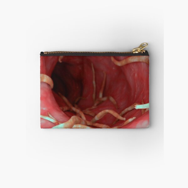 Item preview, STK701570H-Ascaris lumbricoides in the human intestines. designed and sold by StocktrekImages.