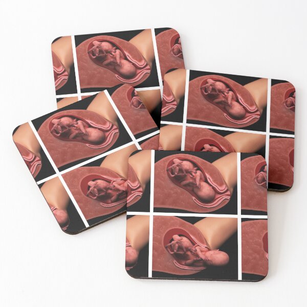 Item preview, STK701577H-Birth stages in a human female. designed and sold by StocktrekImages.