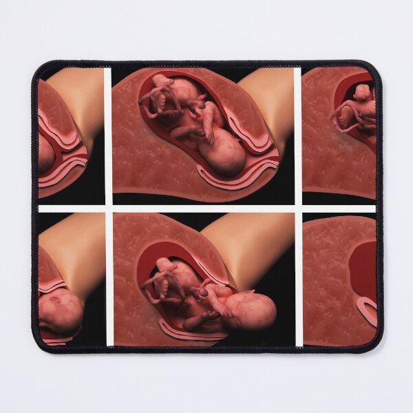Item preview, STK701577H-Birth stages in a human female. designed and sold by StocktrekImages.
