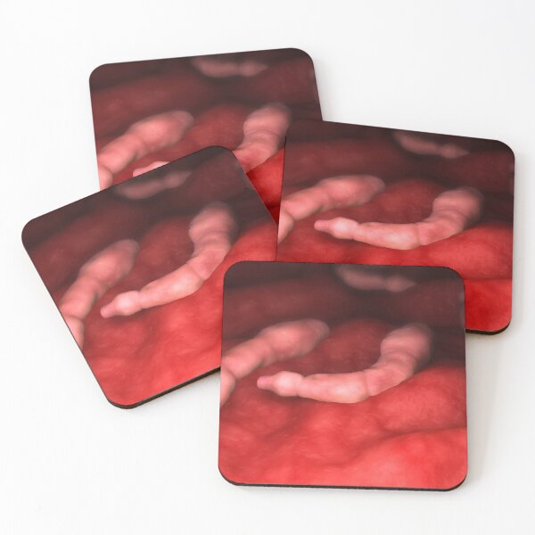 Item preview, STK701593H-Echinococcus parasites inside the liver. designed and sold by StocktrekImages.