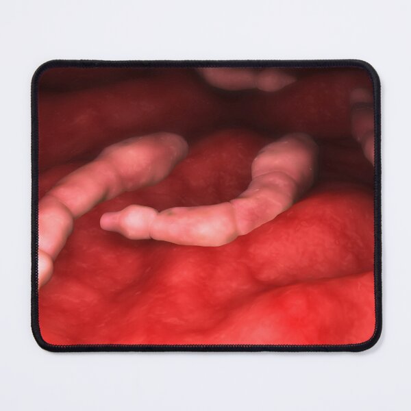 Item preview, STK701593H-Echinococcus parasites inside the liver. designed and sold by StocktrekImages.