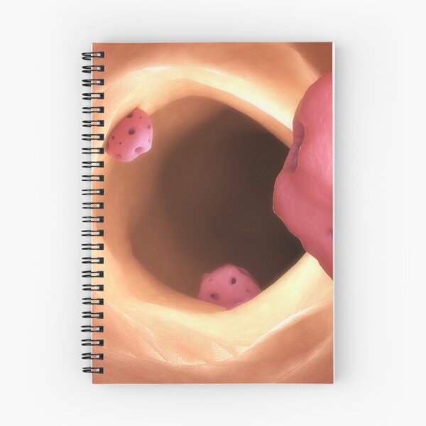 Item preview, STK701598H-Entamoeba inside the intestine. designed and sold by StocktrekImages.