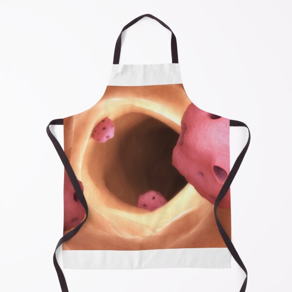 Item preview, STK701598H-Entamoeba inside the intestine. designed and sold by StocktrekImages.