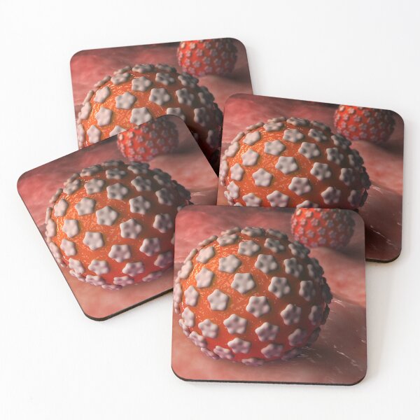 Item preview, STK701614H-Genital warts on surface. designed and sold by StocktrekImages.