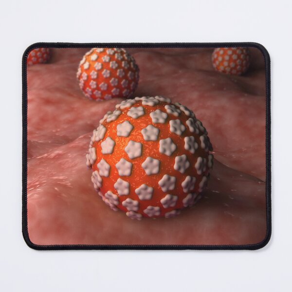 Item preview, STK701615H-Genital warts on surface. designed and sold by StocktrekImages.