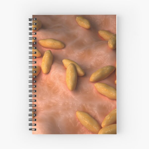 Item preview, STK701630H-Illustration of brucellosis. designed and sold by StocktrekImages.