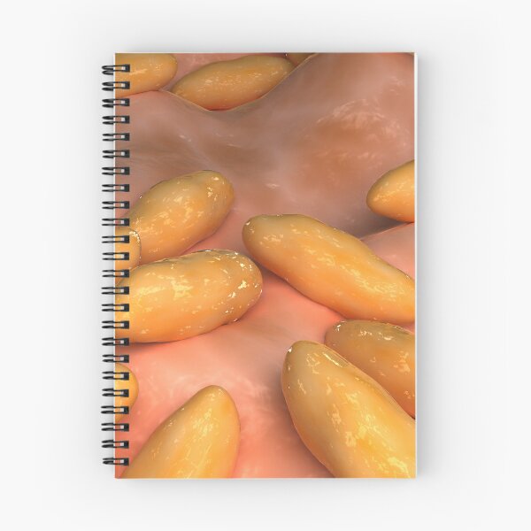 Item preview, STK701631H-Illustration of brucellosis. designed and sold by StocktrekImages.