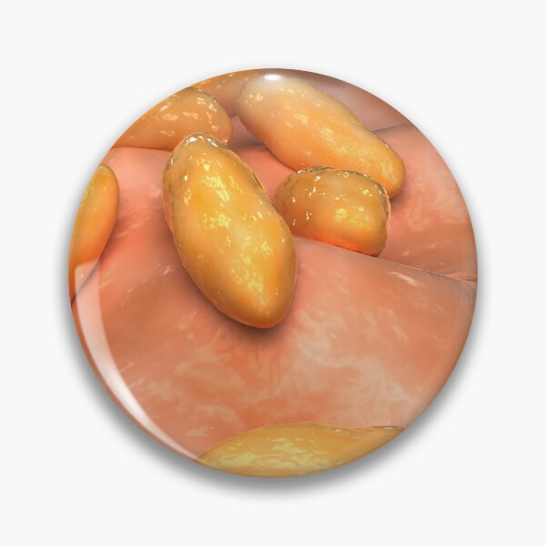 Item preview, STK701633H-Illustration of brucellosis. designed and sold by StocktrekImages.
