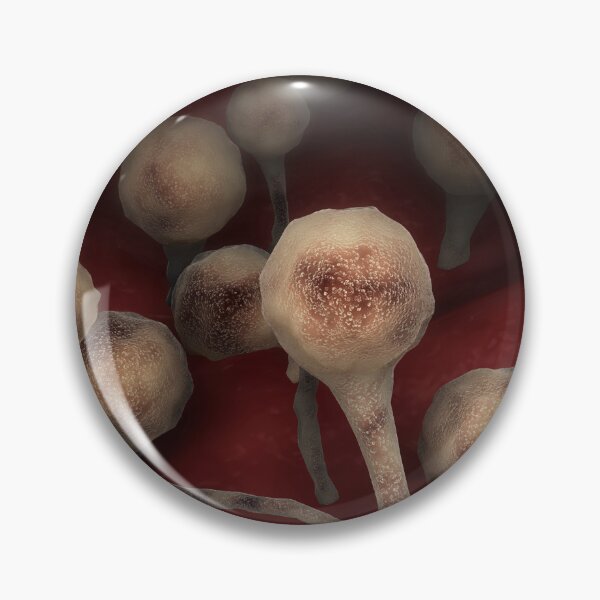 Item preview, STK701642H-The fungal infection mucormycosis. designed and sold by StocktrekImages.