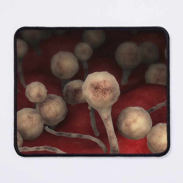 Item preview, STK701642H-The fungal infection mucormycosis. designed and sold by StocktrekImages.