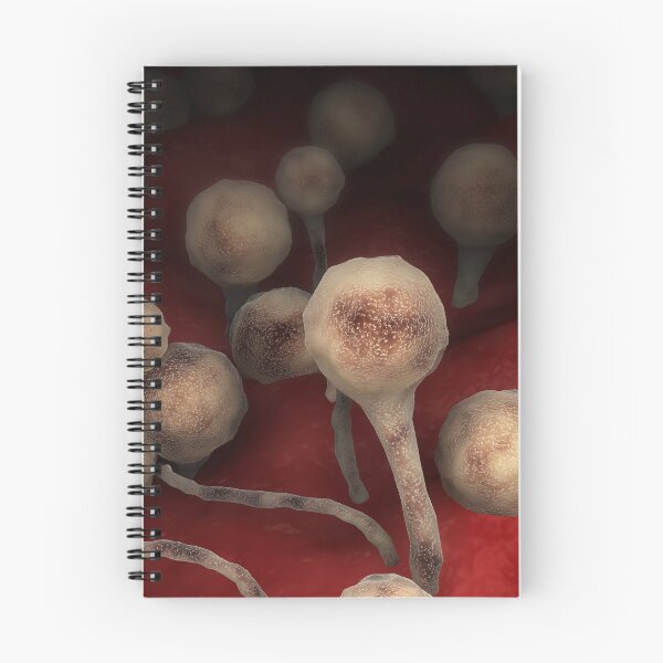 Item preview, STK701642H-The fungal infection mucormycosis. designed and sold by StocktrekImages.