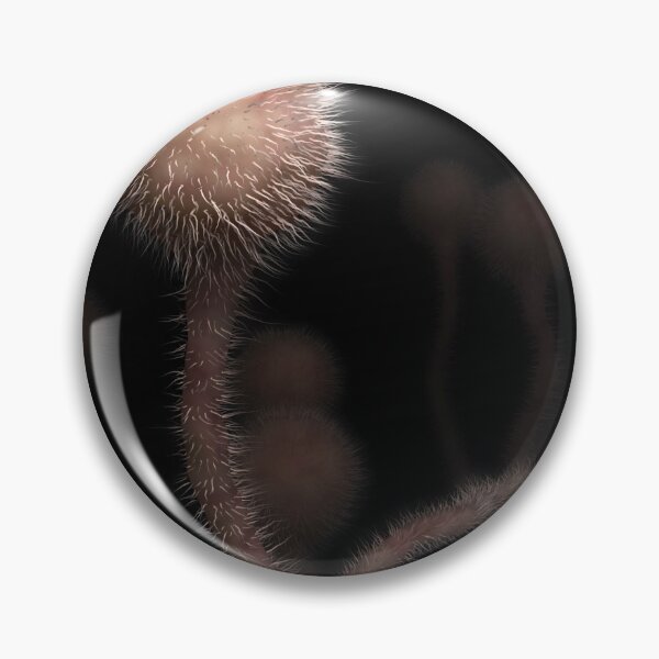 Item preview, STK701644H-The fungal infection mucormycosis. designed and sold by StocktrekImages.