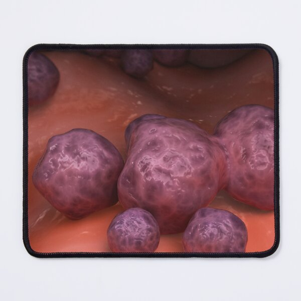 Item preview, STK701647H-Paracoccidioidomycosis fungal infection. designed and sold by StocktrekImages.