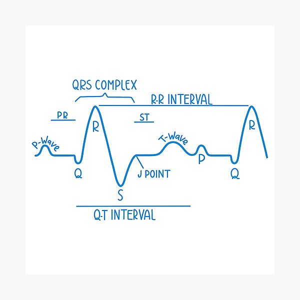 Aperçu de l'œuvre Électrocardiogramme normal dessiné à la main ECG bleu créée et vendue par SofiaSava01.