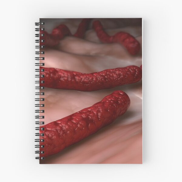Item preview, STK701663H-Streptobacillus moniliformis bacteria. designed and sold by StocktrekImages.