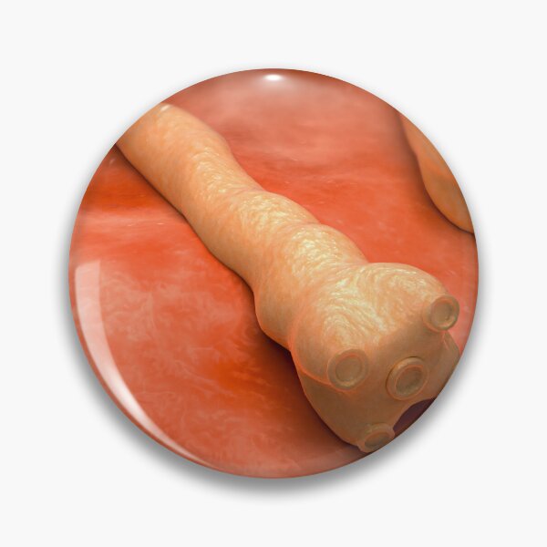 Item preview, STK701666H-Illustration of tapeworms. designed and sold by StocktrekImages.