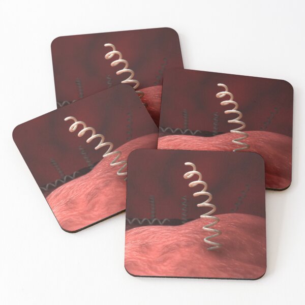 Item preview, STK701673H-Illustration of Treponema pallidum bacteria. designed and sold by StocktrekImages.