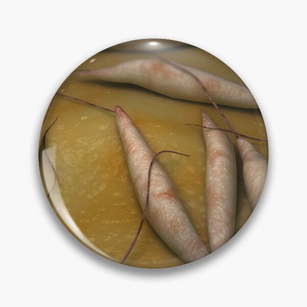 Item preview, STK701682H-Illustration of visceral leishmaniasis. designed and sold by StocktrekImages.
