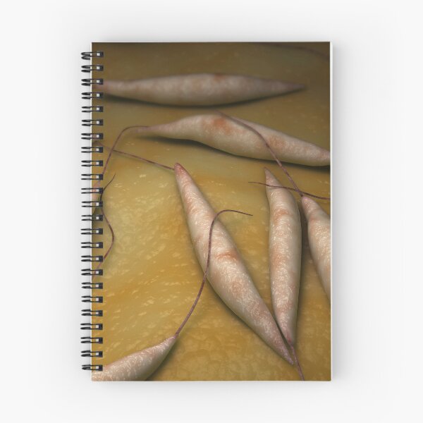 Item preview, STK701682H-Illustration of visceral leishmaniasis. designed and sold by StocktrekImages.