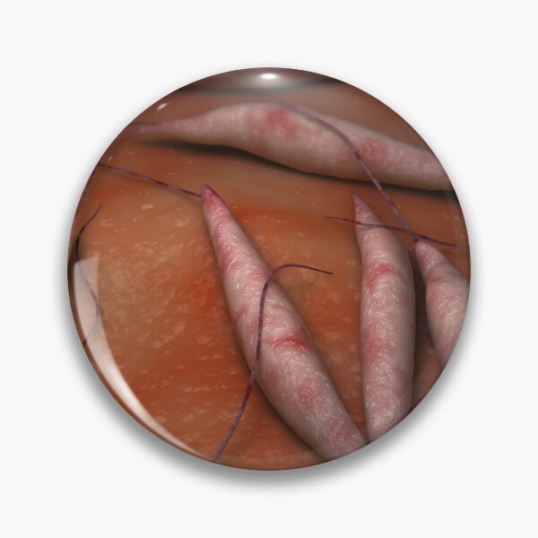 Item preview, STK701683H-Illustration of visceral leishmaniasis. designed and sold by StocktrekImages.