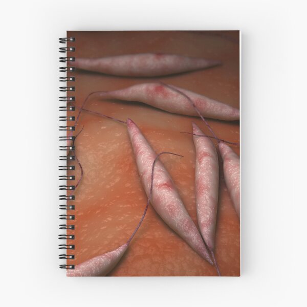 Item preview, STK701683H-Illustration of visceral leishmaniasis. designed and sold by StocktrekImages.