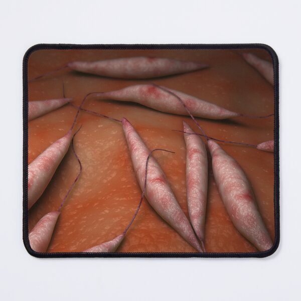 Item preview, STK701683H-Illustration of visceral leishmaniasis. designed and sold by StocktrekImages.