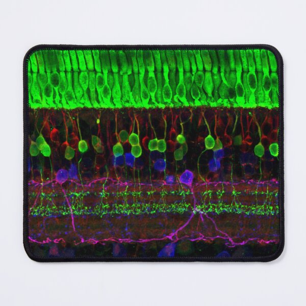 Item preview, Nerve Cells of the Retina designed and sold by goblinmart.