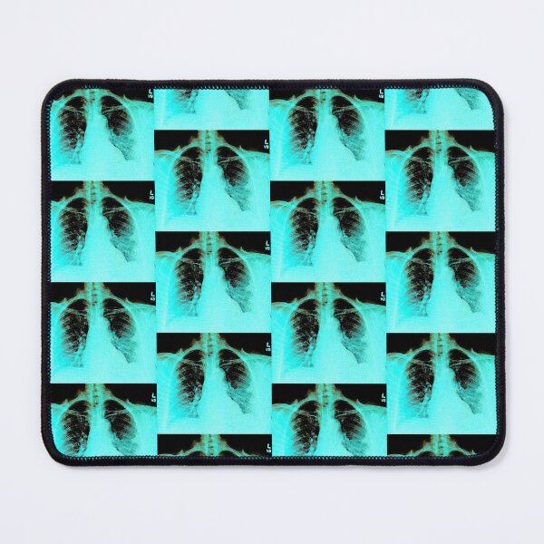 Item preview, Chest X-ray of Patient with COVID-19 Infection designed and sold by Creative Endeavors ..