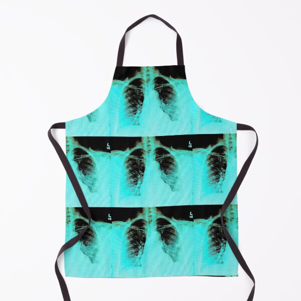 Item preview, Chest X-ray of Patient with COVID-19 Infection designed and sold by Creative Endeavors ..